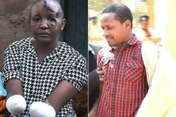 This Kenyan Woman Whose Hands Were Chopped Off By Husband Gets New Pair (Photo)